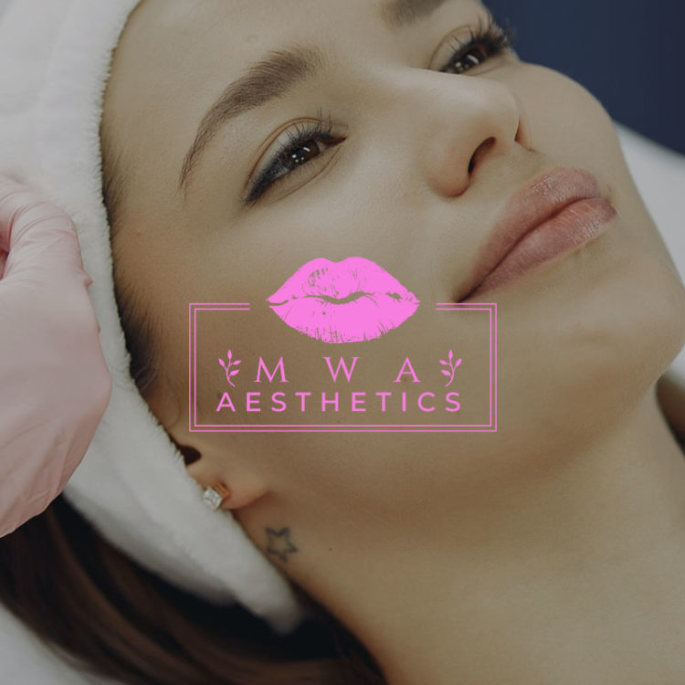 Microneedling Aesthetic Treatment